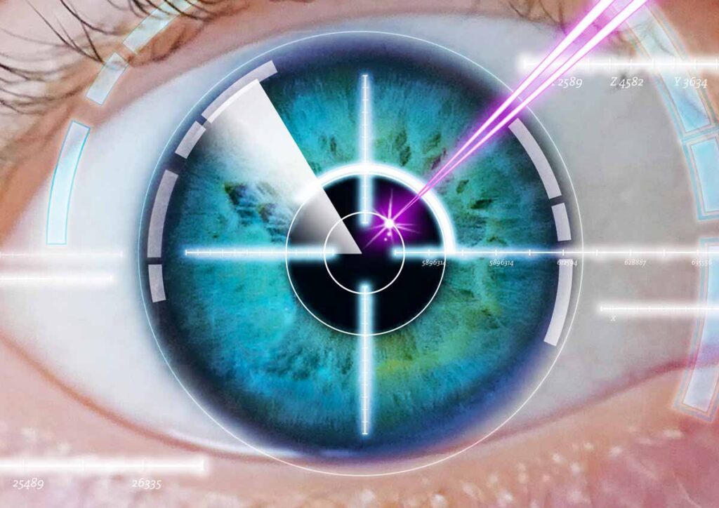 What Makes Lasik Eye a Popular Choice for Vision Correction